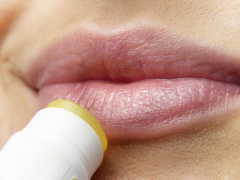 Chapped lips are a symptom of nicotine allergy