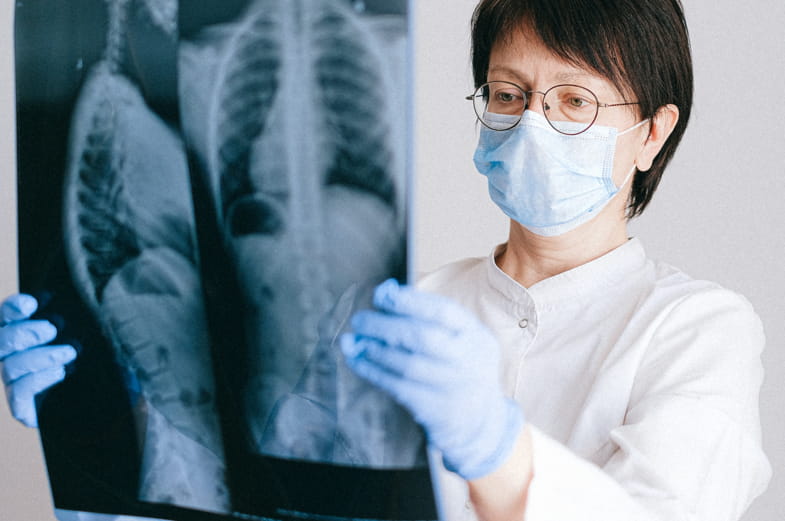Doctor checking a patient's lung x-ray | Terpy 